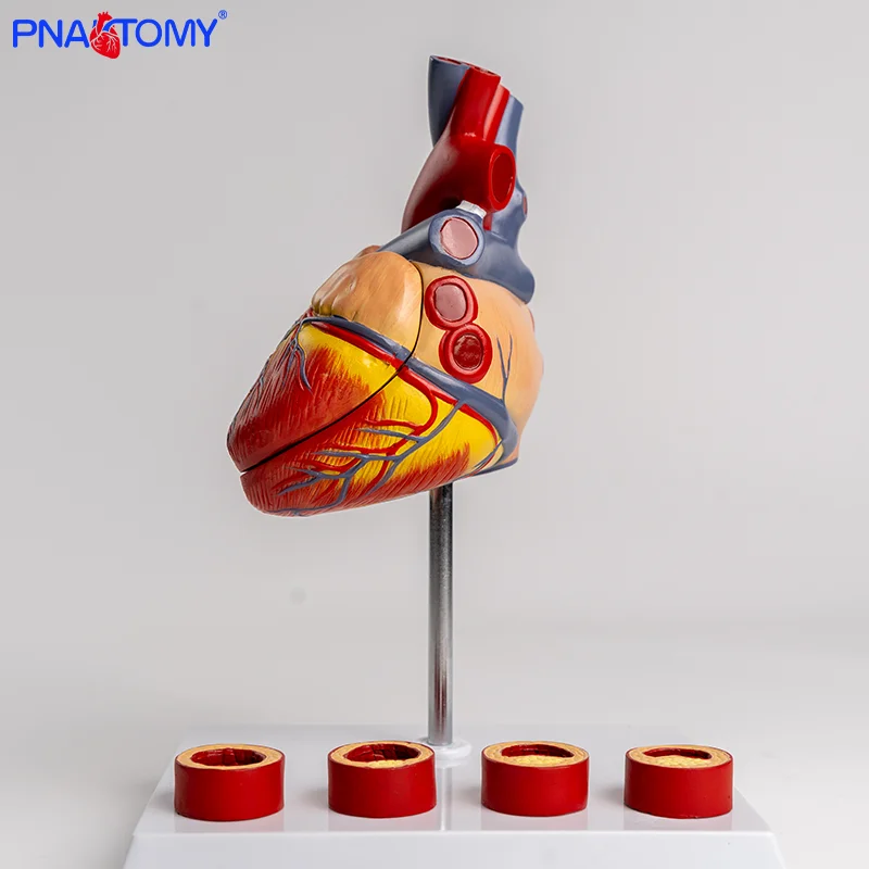 Heart Thrombus Model Anatomically Dissectable Teaching Simulation Natural-sized Heart Thrombus Vascular Model