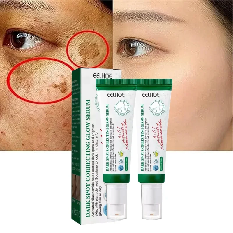 Dark Spot Correcting Glow Serum,Dullness,Acne,And Melanin Remover,Niacinamide Facial Skin Moisturizing Brightening Skincare