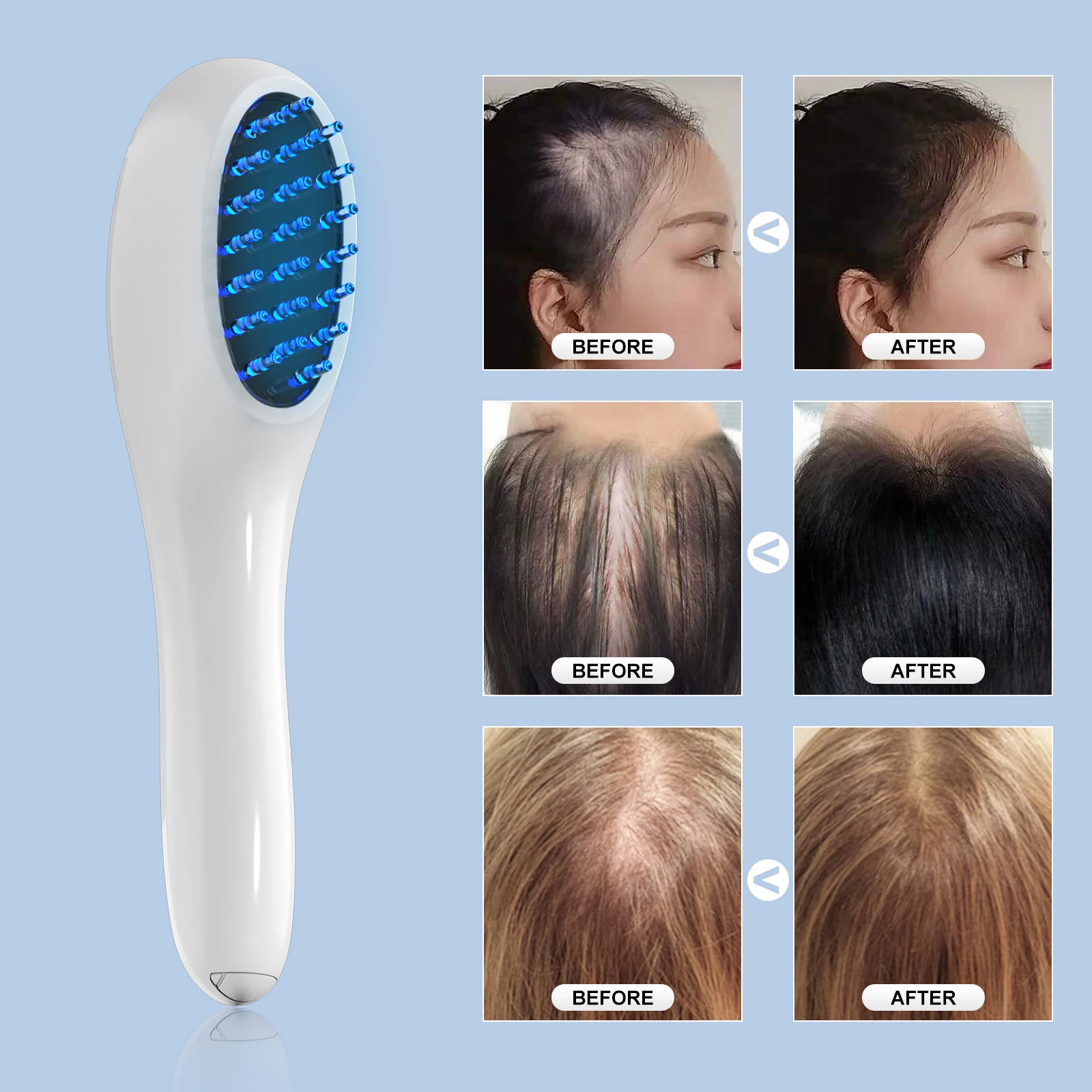 Medical Grade Red Blue Light Hair Growth Comb Electric Scalp Massager Anti Hair Loss Phototherapy Laser Portable Hair Brush