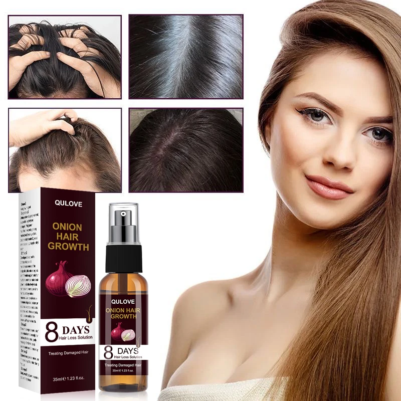 QULOVE Hair Products Ginger Hair essence spray Hair Sparse Care Hair Care Essential Oil Intensive Hair Growth Beauty 35m