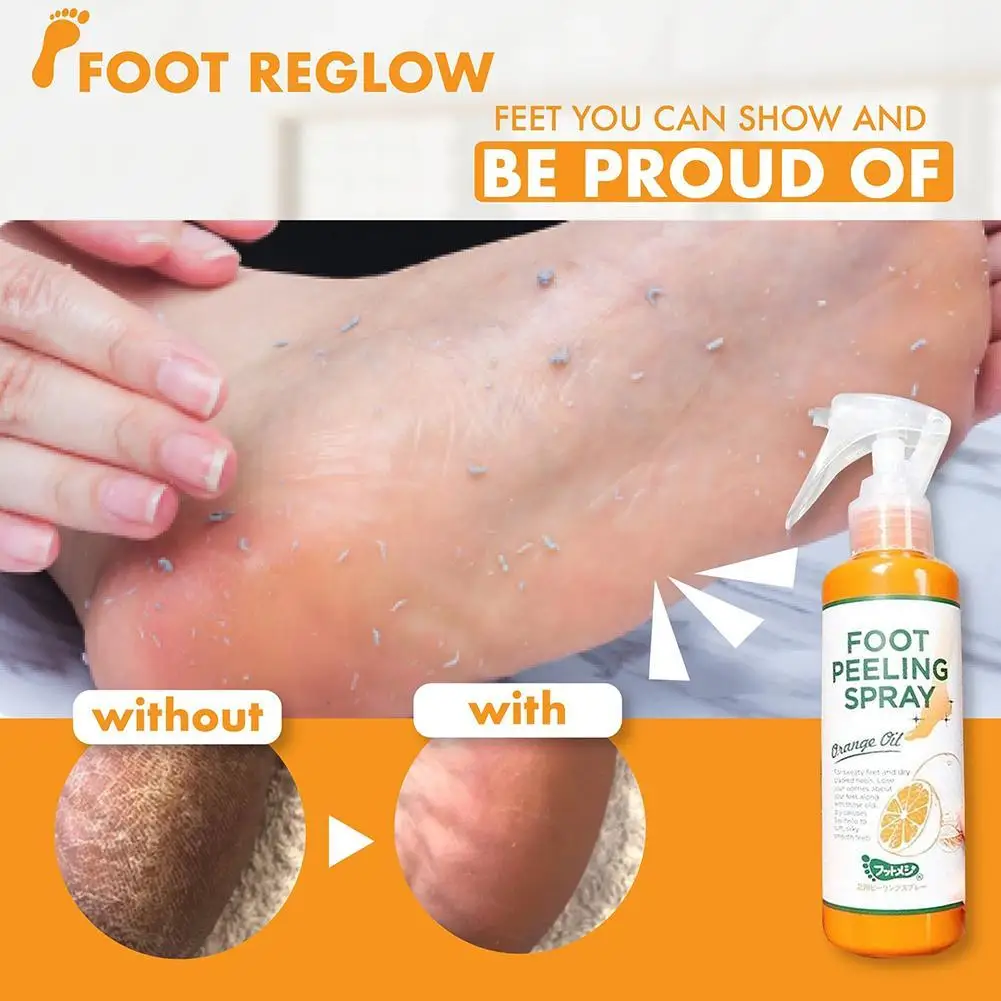 Foot Peeling Spray Cleansing Antimicrobial Natural Orange Podiatry Spray Pedicure Hands Dead Skin Exfoliator Foot Care Detox