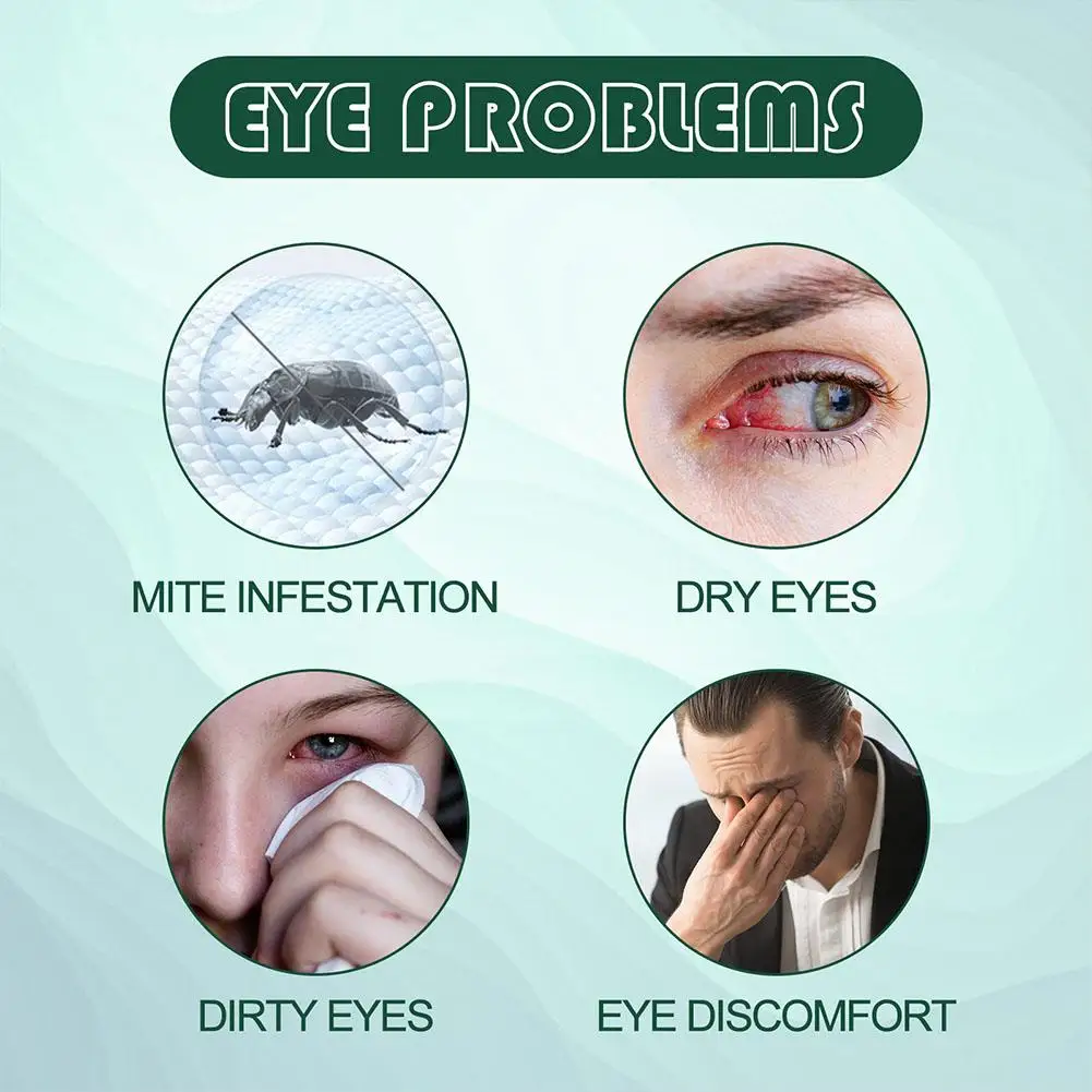 20Pcs Eyelid Cleansing Wipes Mite Removal Wet Wipes Natural Eyelash Makeup Remover For Blepharitis Itchy Stye Eyes