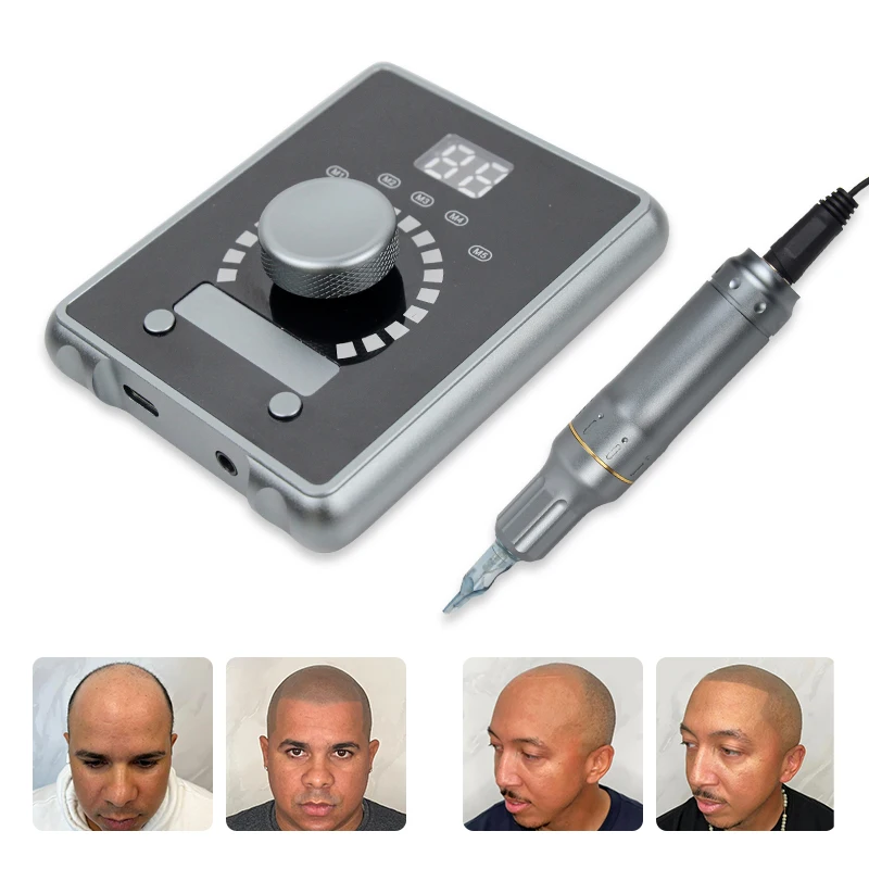 Aimoosi Scalp Tattoo Tattoo SMP Hair Stroke Machine Scalp Micropigmentation tattoo machine  Permanent Makeup