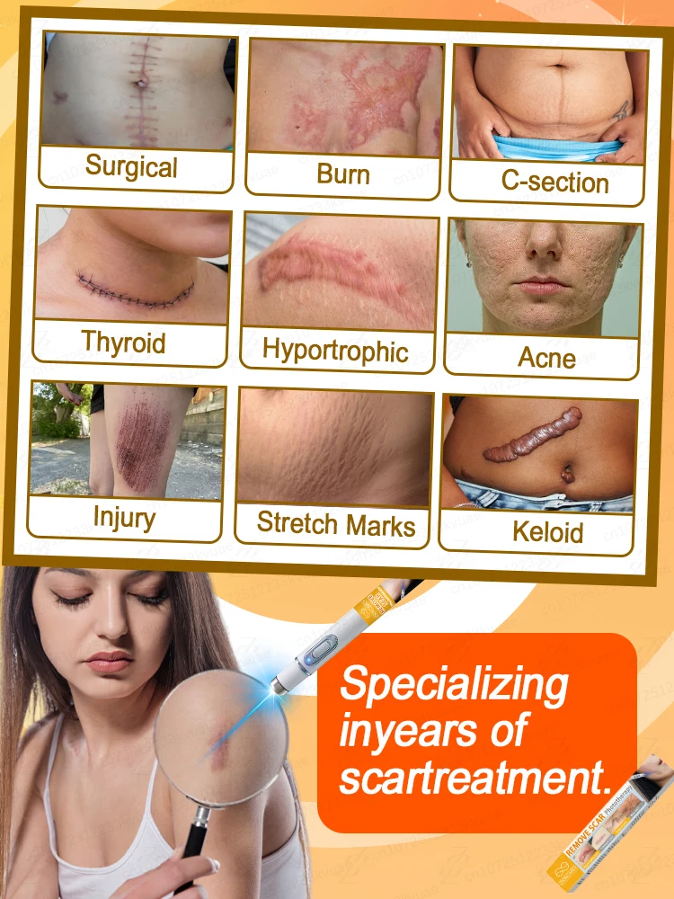 Can deeply repair various stubborn scars and solve your problems