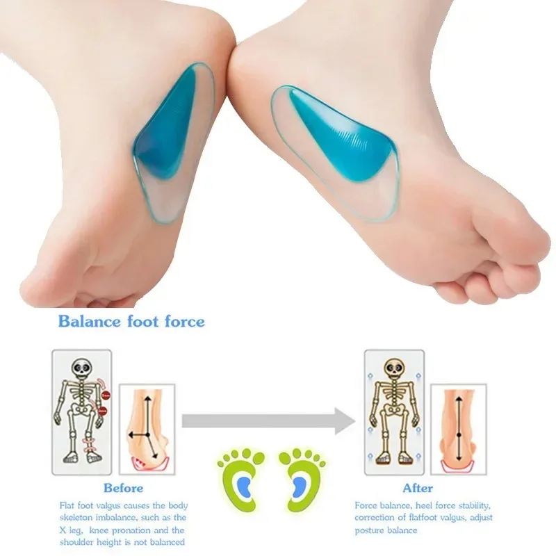 Professional Silicone GelOrthoticInsolesArchSupportShoeInsertsFlatFootCorrectorCushion Pads FootPainReliefOrthopedicShoeCushions