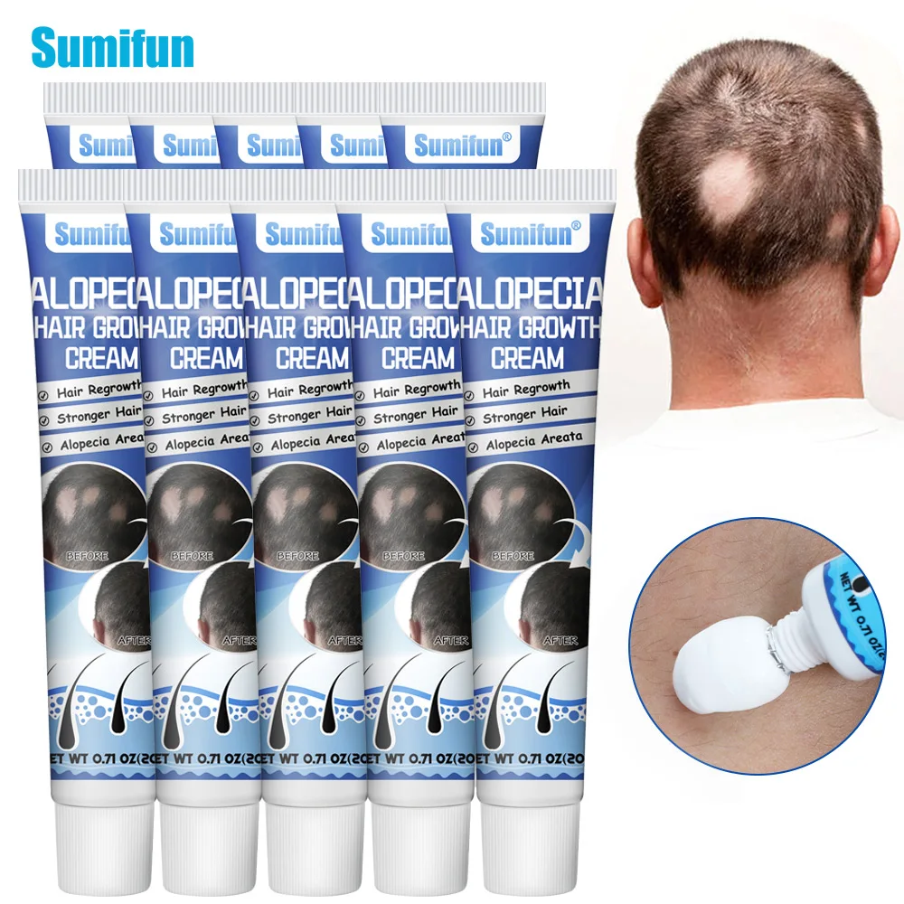 1-30pcs Hair Growing Cream Alopecia Baldness Fast Regrowth Repair Ointment Treat Grow Thicker/Longer Hairs Root Nourish Plaster