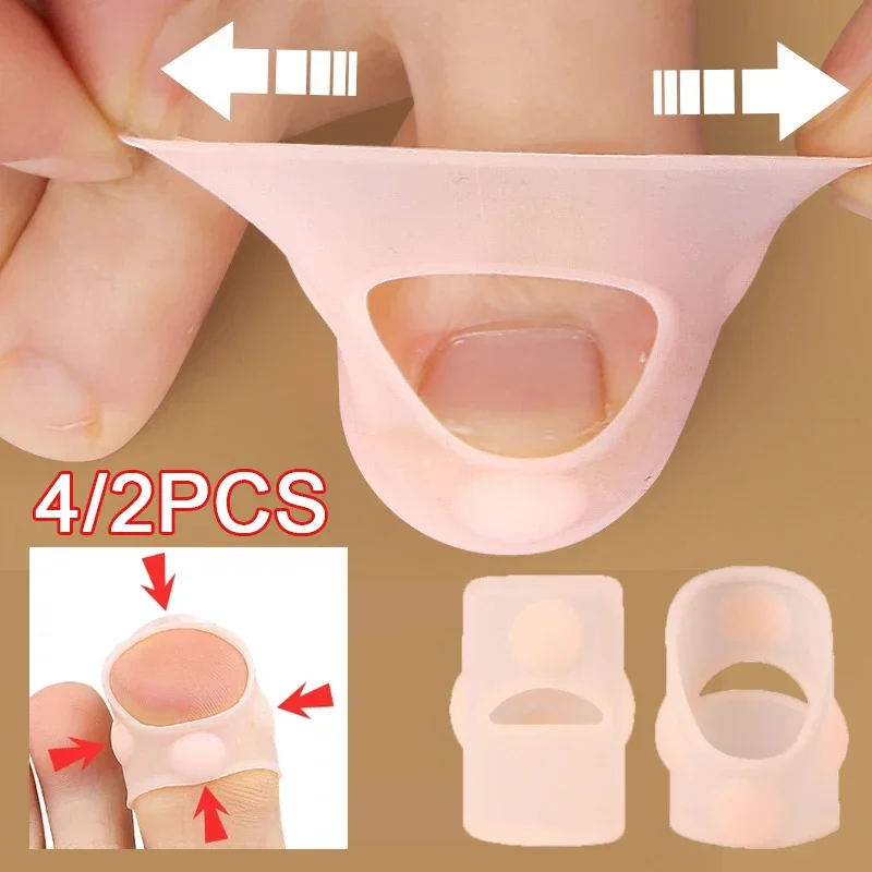 Silicone Ingrown Toenail Correction Tool Invisible Ingrown Toe Nail CoverElastic Straightening Clip Brace Foot Tool