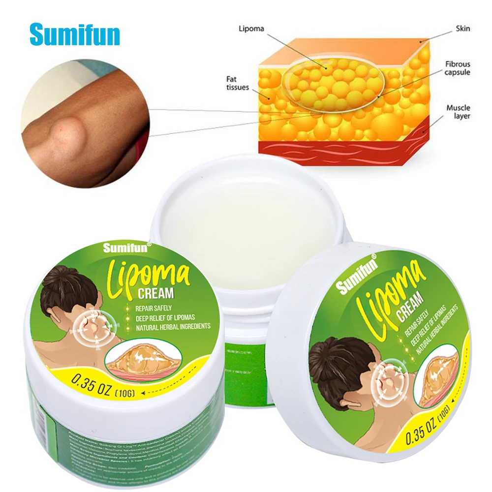 

Sumifun 10g Herbal Lipoma Removal Cream Reduce Inflammation Treat Subcutaneous Lumps Fat Pack Remove Medical Tubercle Care Cream