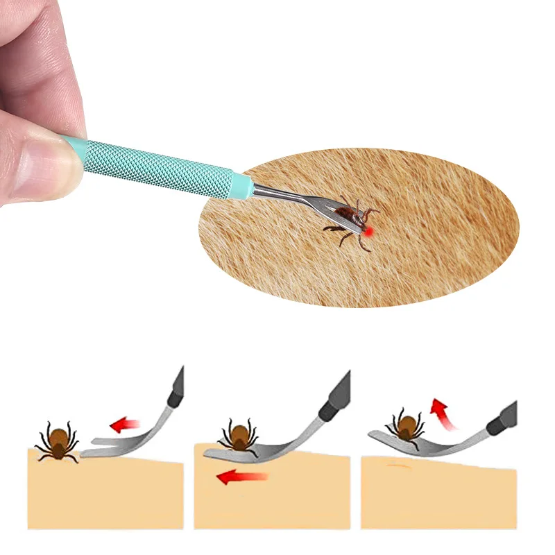 Stainless Steel Tick Removal Kit For Dogs - Professional Grade Lice Removal Tweezers, Ideal For Pet Dogs & Cats, Durable And Eas view 3