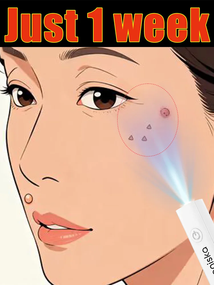 Laserpen, Bescherm uw gezondheid