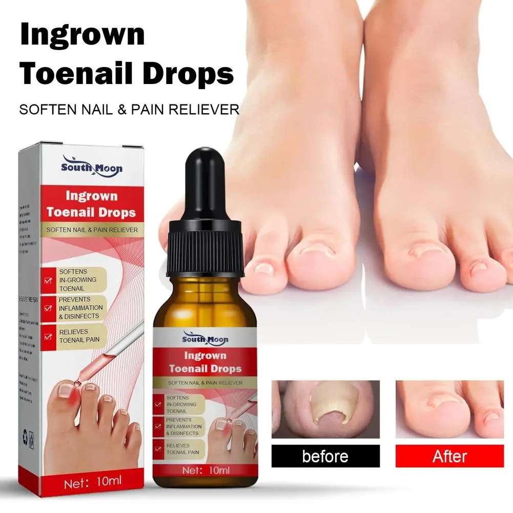 Ingrown Toenail Tratamento Soro, Correção das unhas, Recuperar Óleo, Pain Reliever, Unhas Amaciante, Guarnição com Facilidade Óleo, Saúde Pés, 3 Pcs, 2 Pcs, 1Pc