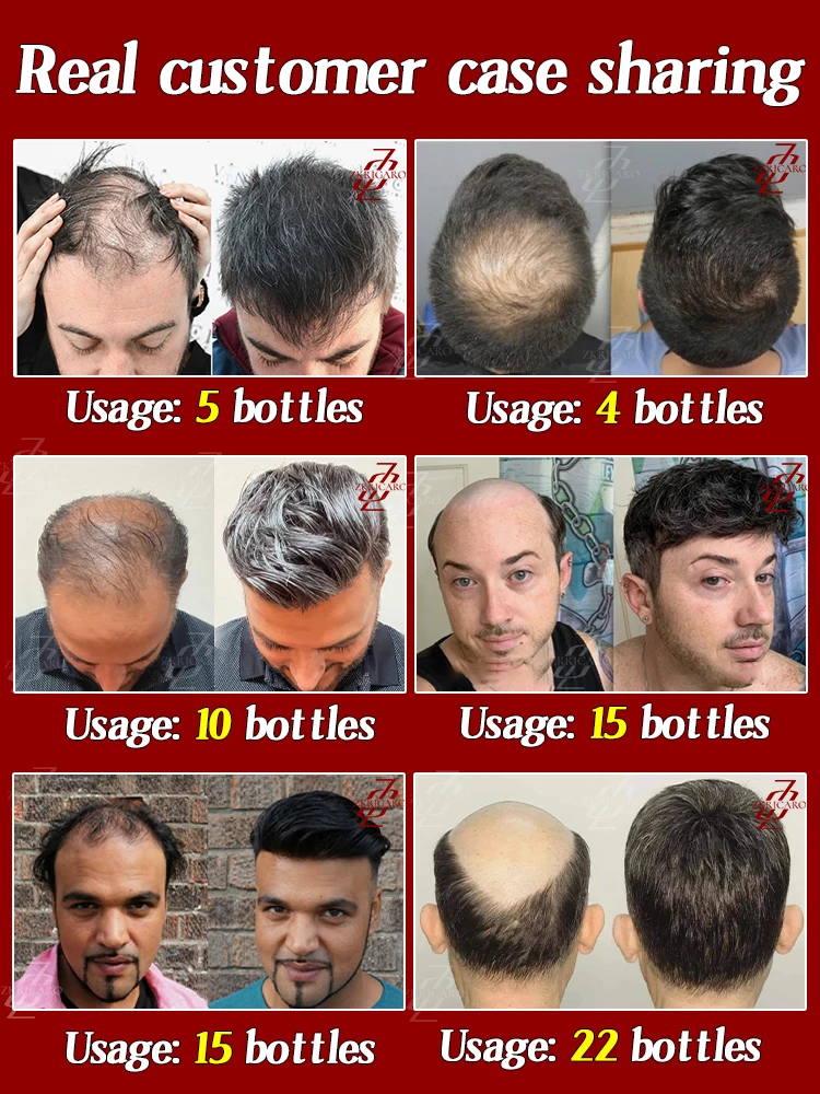 Upgraded haír root care 0íl, thick haír, thíck haír roots, effectíve in 7 days, Save Your Haír