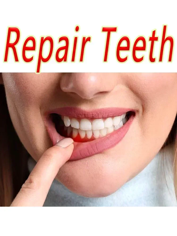 Extracto de planta Natural para reparar la caries dental, blanquear los dientes, eliminar las manchas de limpieza de los dientes, eliminar las manchas de cigarrillos, reducir el amarillo