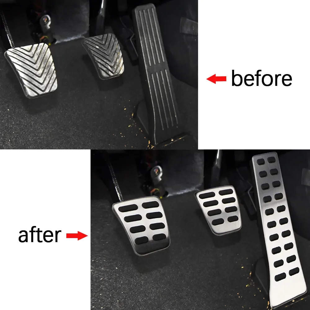For Hyundai Tucson Santa Fe NEXO Palisade I40 Ix45 Ix35 Genesis Elantra GT for Kia Sorento Optima Sportage QL Pedals Pedal Cover