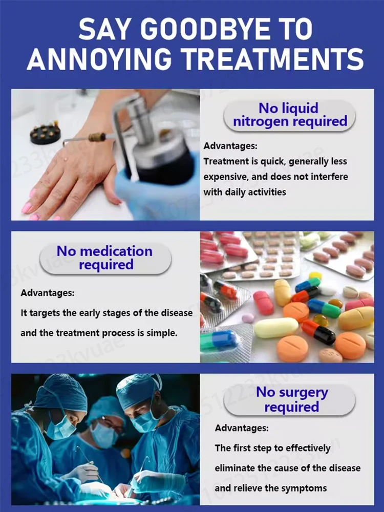 Blue light wart tool, more discounts on sets