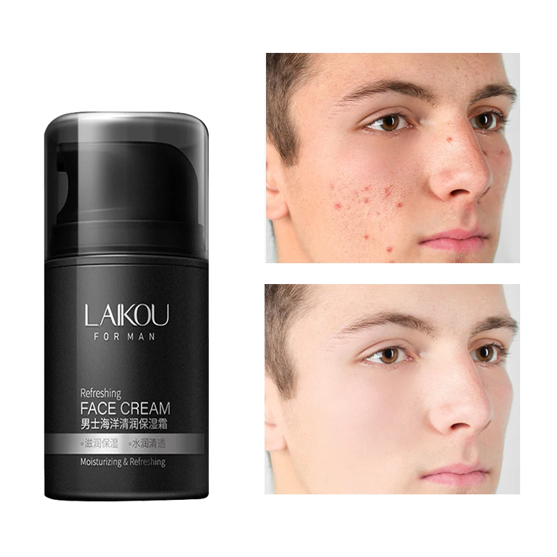 

Men's Moisturizing Cream Sodium Hyaluronate Whitening Moisturizing Lifting And Firming Oil Control Clean Pores Skin Cream