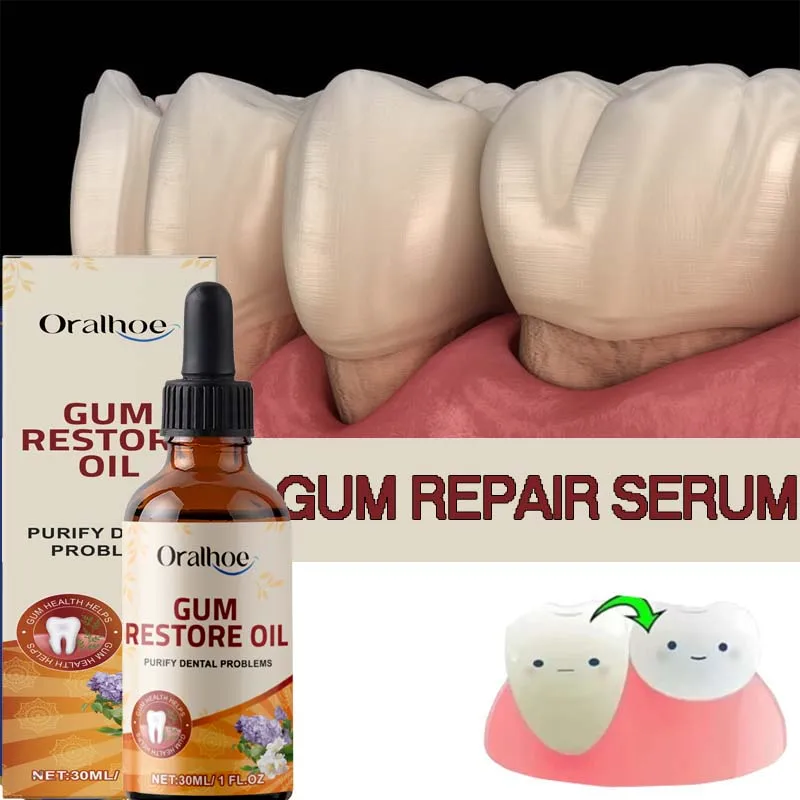Rapid Repair Gums Serum Effectively Relieve Tooth Allergy Dental Caries Cleaning Toothpaste Relieve Tooth Damage Drops gx&nfc