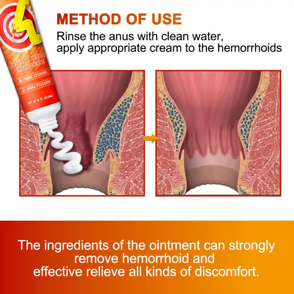 أنبوب مرهم لتخفيف الآلام من البواسير ، علاج البواسير ، لحكة سريعة المفعول ، وتورم ، وقوة قصوى