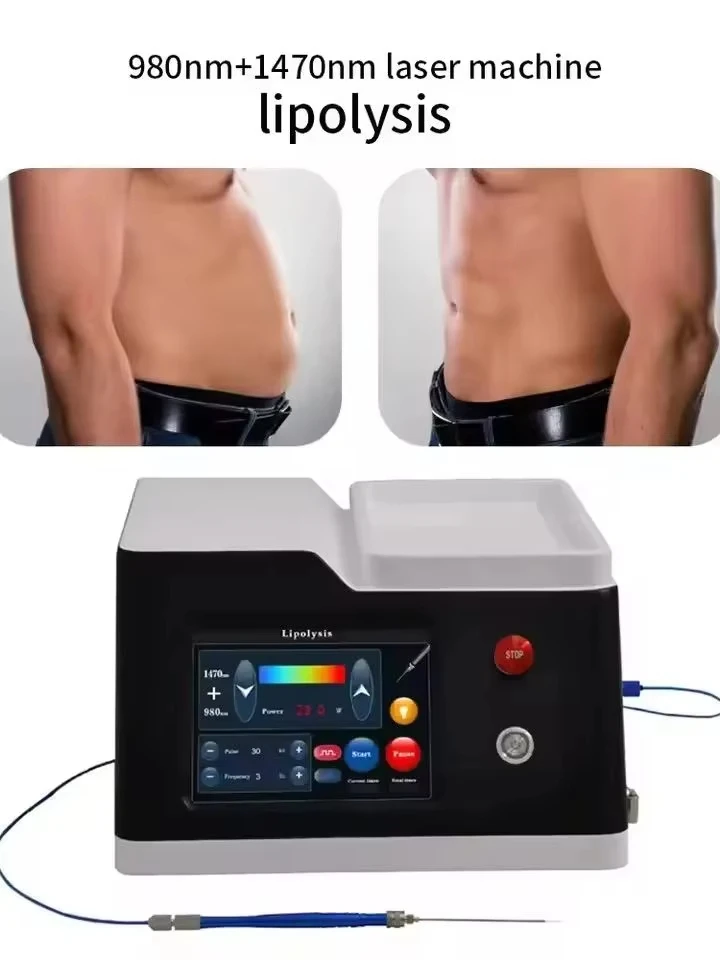 

epilator2026 New Source Factory 1470nm 980nm Diode SLyricLaser 2 wavelengths for Spider vein Portable Surgery Weight Loss device