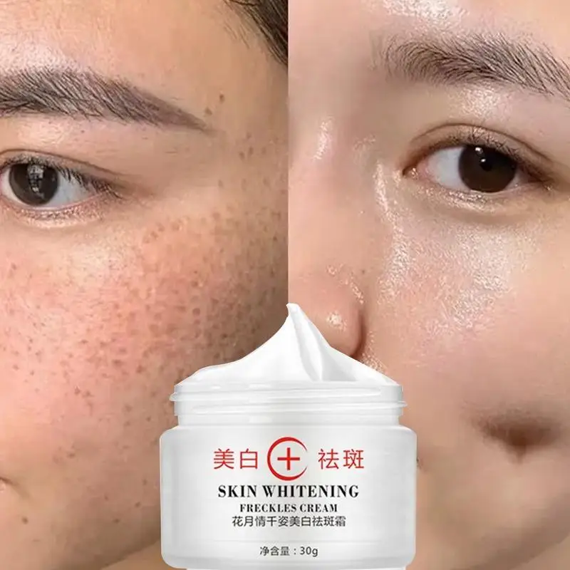 

Best quality whitening cream dark spot remover cream face pigment melasma and freckles removal cream