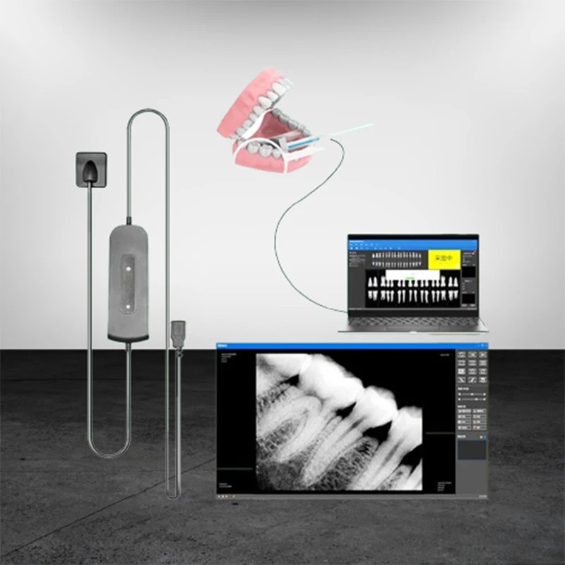 

Dental Sensor X-Ray Dentistry High-Frequency Rx Digital Intraoral Digital System H D Image Radiovisografo Dental Digital Sensor