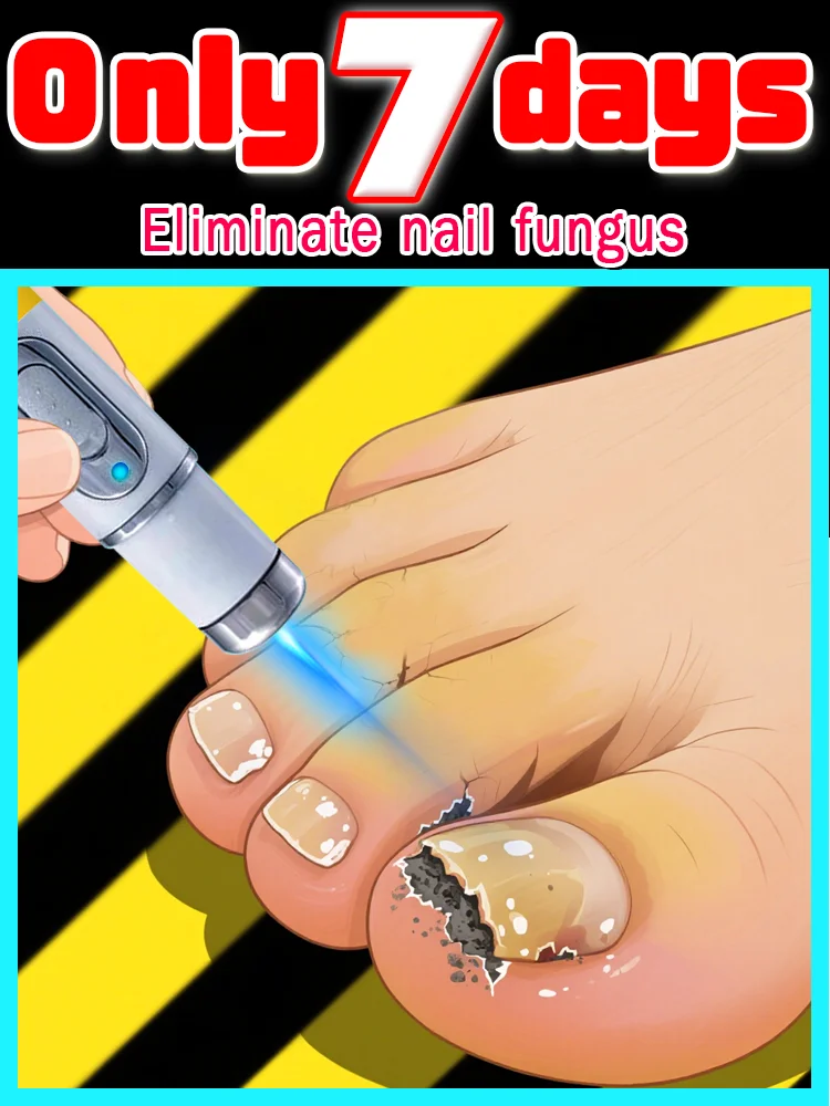 

Laser pen blue light eliminates fungal infections, odor, and itching in toenails. Laser repair therapy for nail fungus