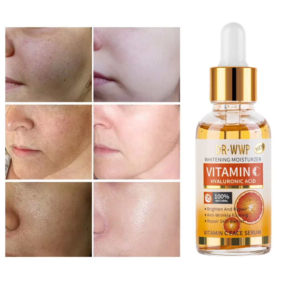 

Disaar Vitamin C 30ml Face Serum Brightening Skin Hyaluronic Acid Moisturizing Essence Anti Wrinkle Improve Dullness Whiten Care