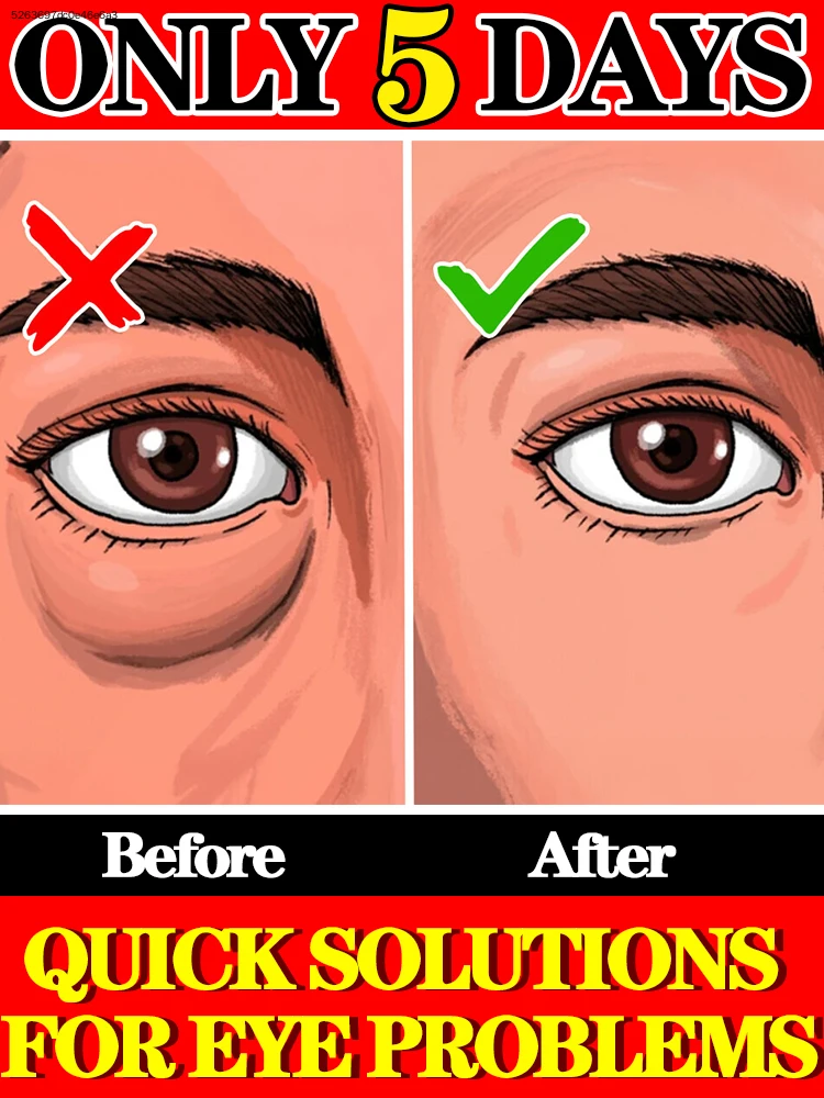 

Мои друзья постоянно спрашивают меня, как мне придать молодостный вид глазам!