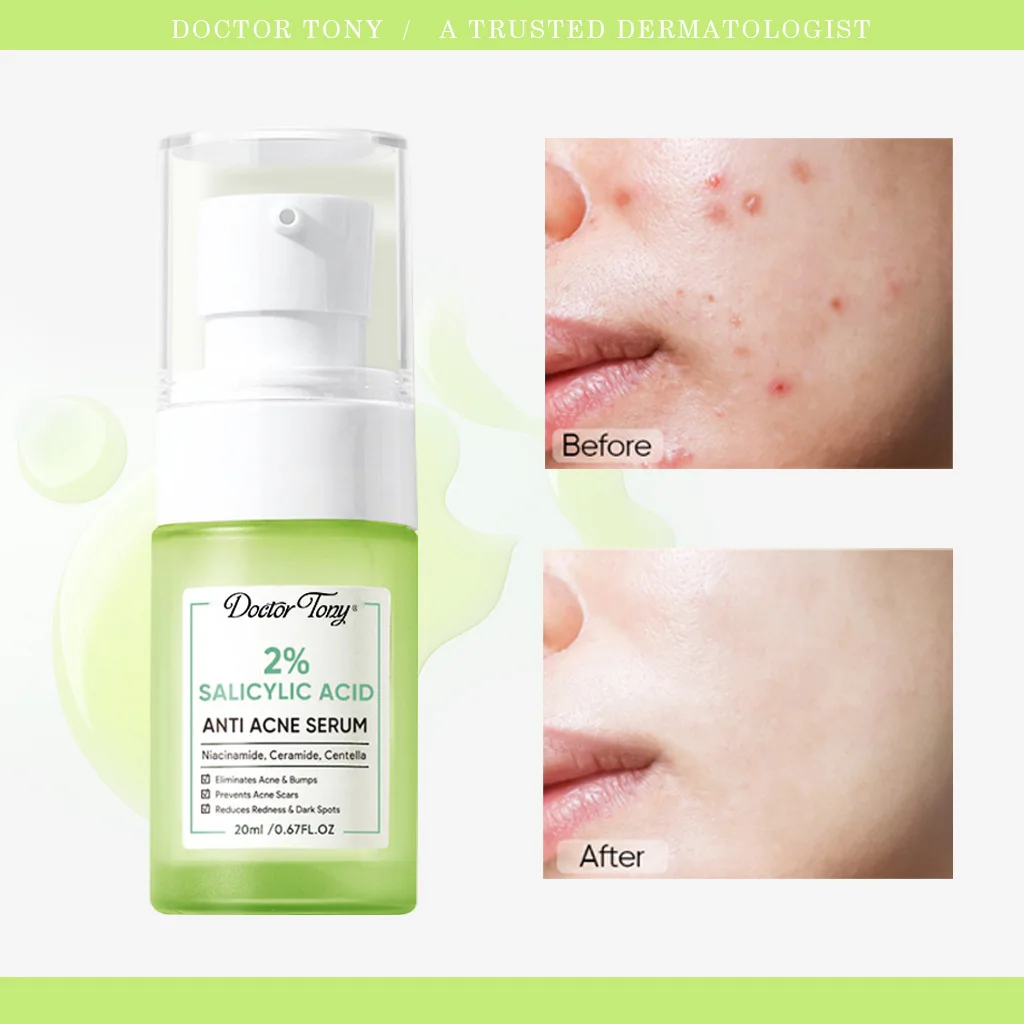 

Salicylic Acid 2% Anti Acne Serum Solution Spot Removing Shrink Pores Oil-Control Brighten Face Skin vitamin c serum for face