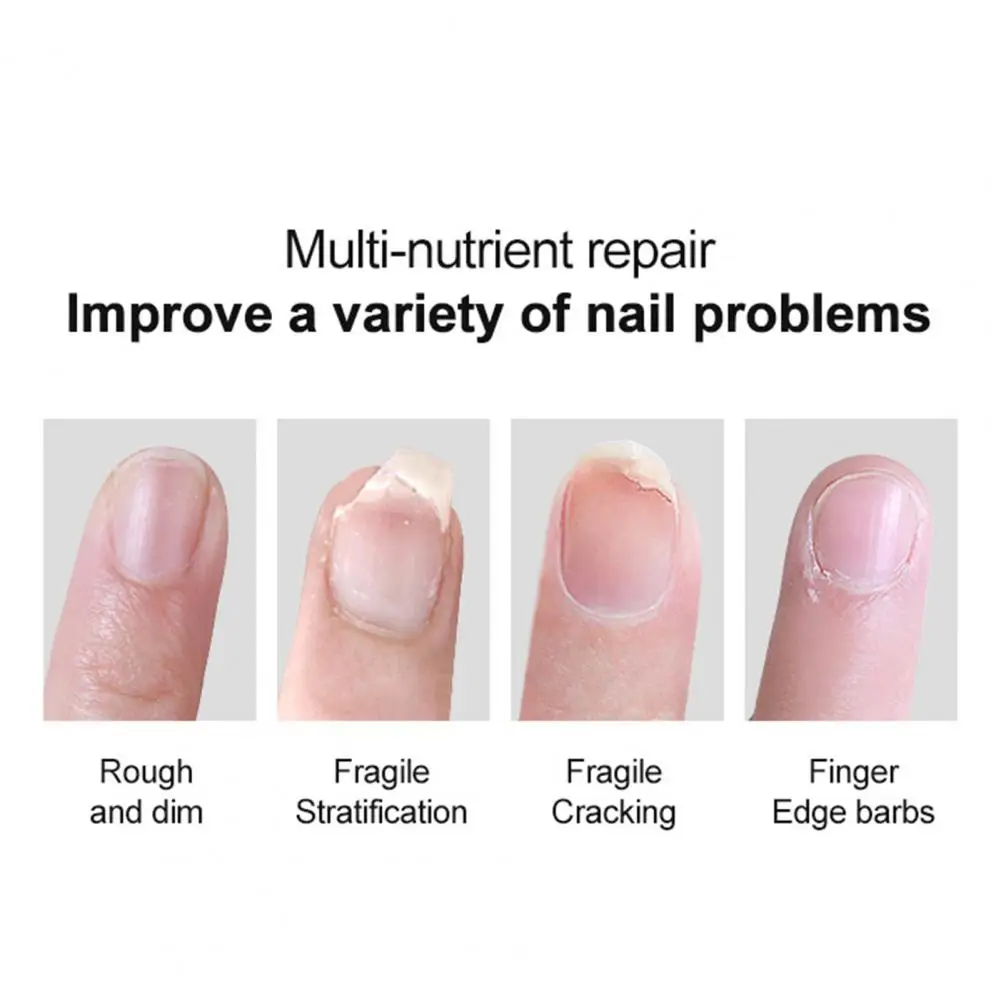 Nail Repair Serum Hydrating Cuticle Oil for Nourished Nails Scented Honey Treatment to Moisturize Repair Damaged Nail for Growth