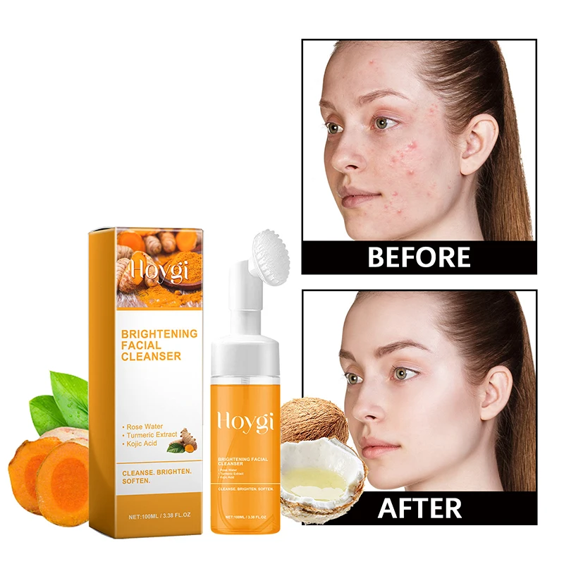 

Turmeric Cleanser Deeply Cleansing Kojic Acid Remover Blackhead Skin Cleansing Oil Control Fade Acne Marks Brighten Foam Cleanse