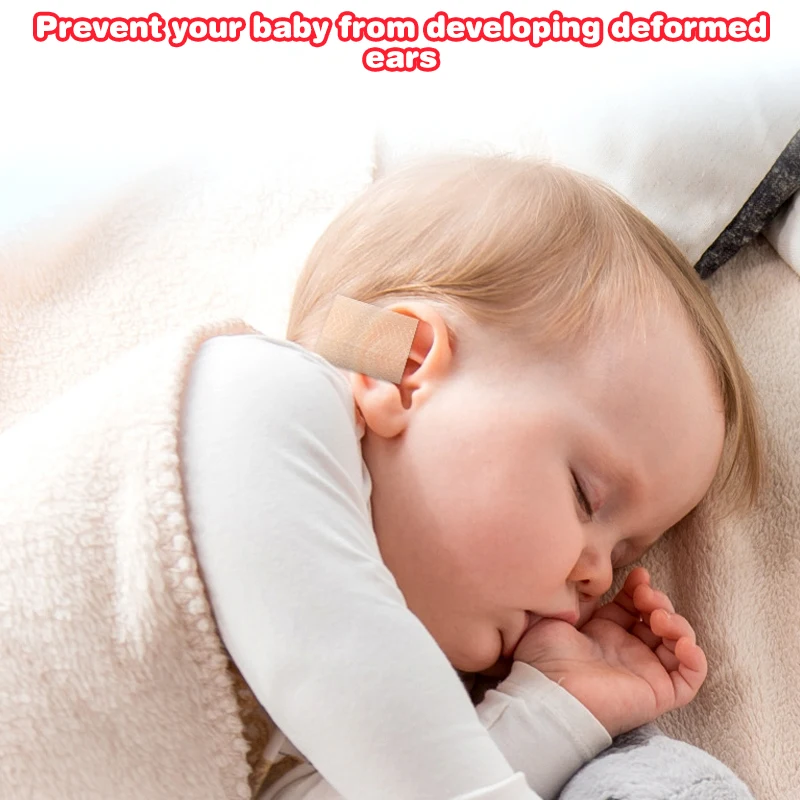 1 Roll 4cm×0.5m Baby Ear Corrector Infant Protruding Ears Correction Silicone Kids Ear Aesthetic Correctors Patch Sticker
