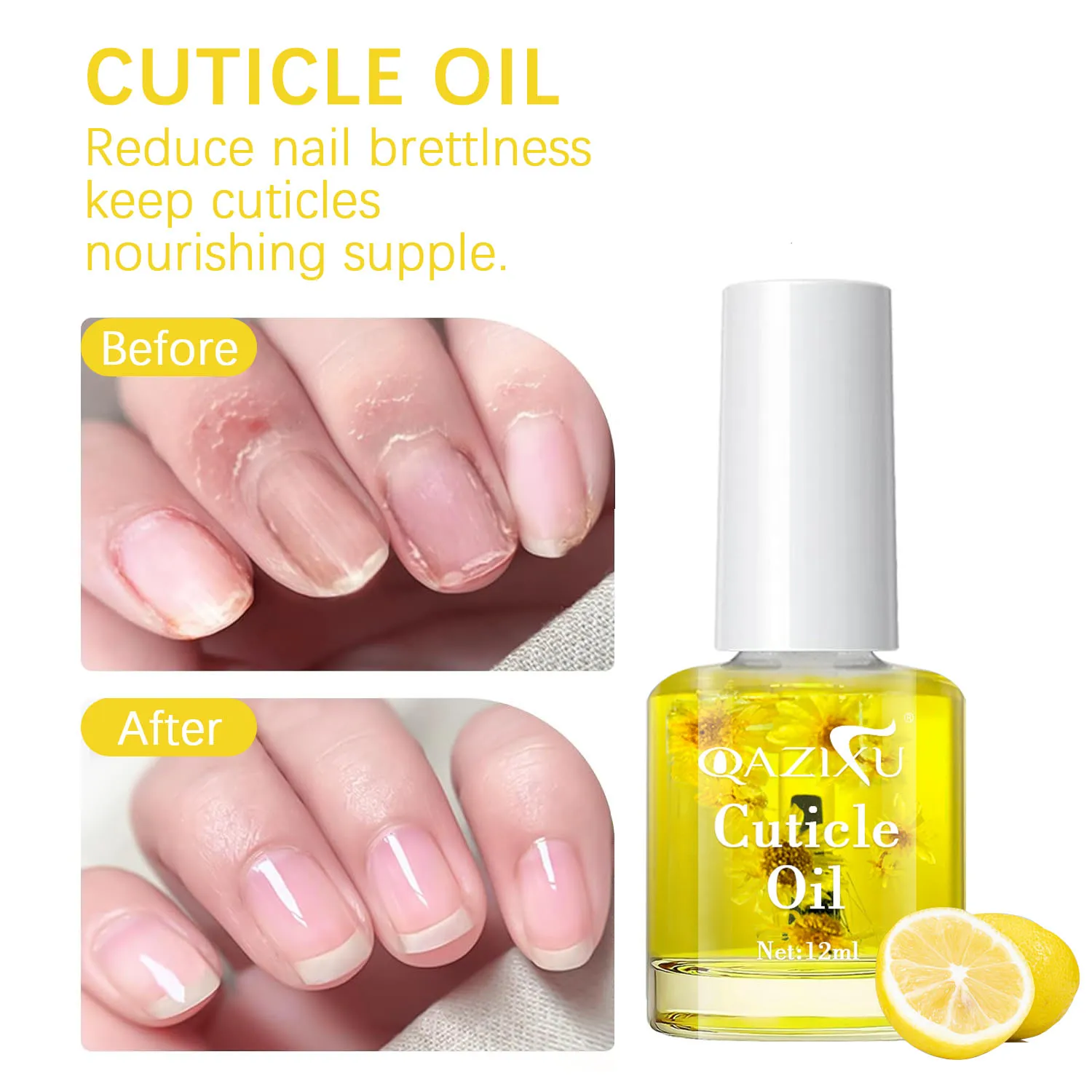 QAZIXU 12 مللي مزيل بشرة الأظافر ومجموعة زيت مغذي للبشرة الميتة للعناية بالأظافر أداة تنظيف البشرة