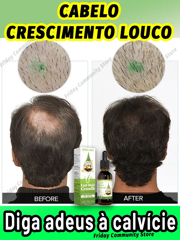 98% de los compradores compran de nuevo, tienen más y más cabello, dios adiós a la calvicie, cabello grueso, producto vendedor caliente