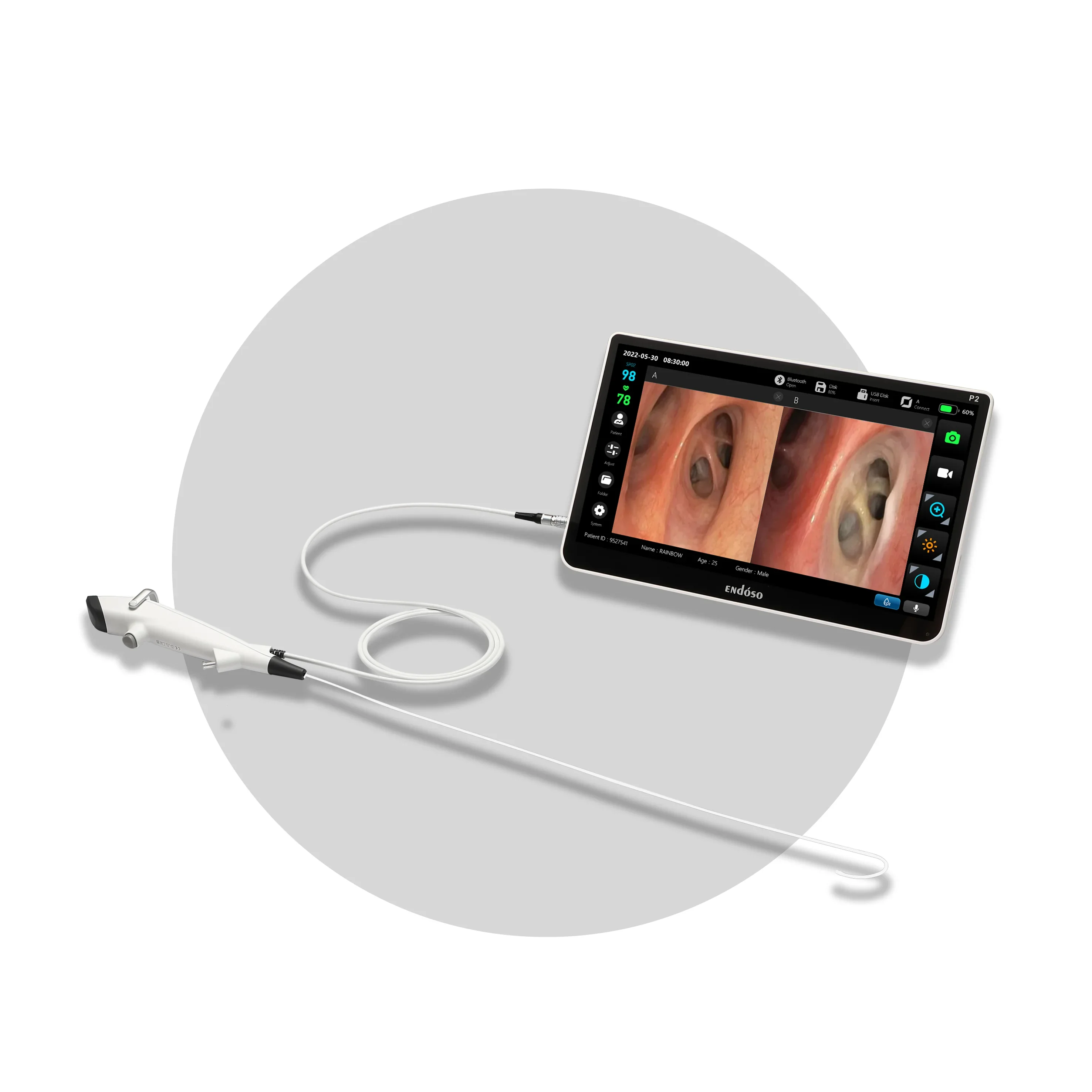 Endoso Hot Sale Handheld Flexible 2.8MM Working Channel Video Bronchoscope ENT Endoscope With Camera Fiber Optic