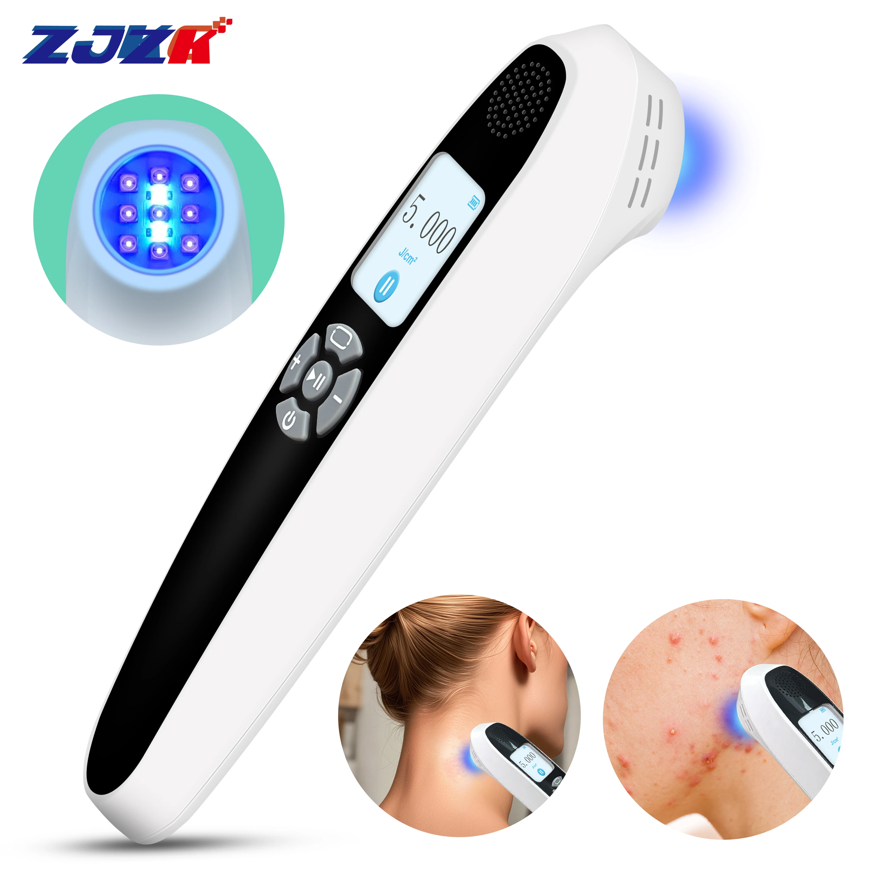 

Excimer Lamp UVB Light Therapy for Psoriasis Acne 308nm Vitiligo Device