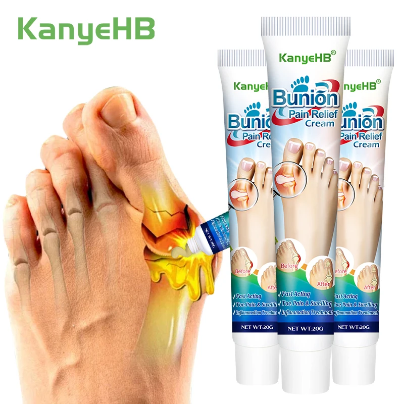 Crema para el dolor de las articulaciones, ungüento para la tenosinovitis, terapia para la artritis y el dolor de los tendones, crema para aliviar el dolor del hallux valgus, A990, 3 uds.
