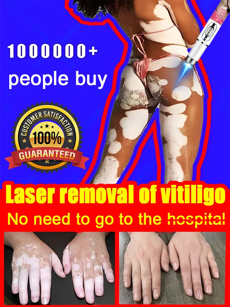 

Efficient laser technology to quickly improve vitiligo