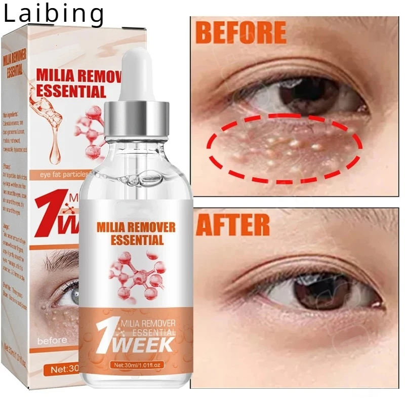 Emove Eye Fa&t Brightening Essence Improve Melanin Skin Smooth Moisturize Eyes Repair Eye Fine Lines Beauty Care Essence Water