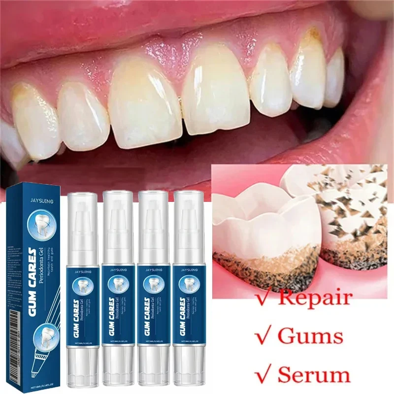 

Damaged Gum Repair Care Serum Relieve Sore Gums Allergy Deep Cleaning Teeth Stains Tartar Essence Dental Caries Toothpaste Gel