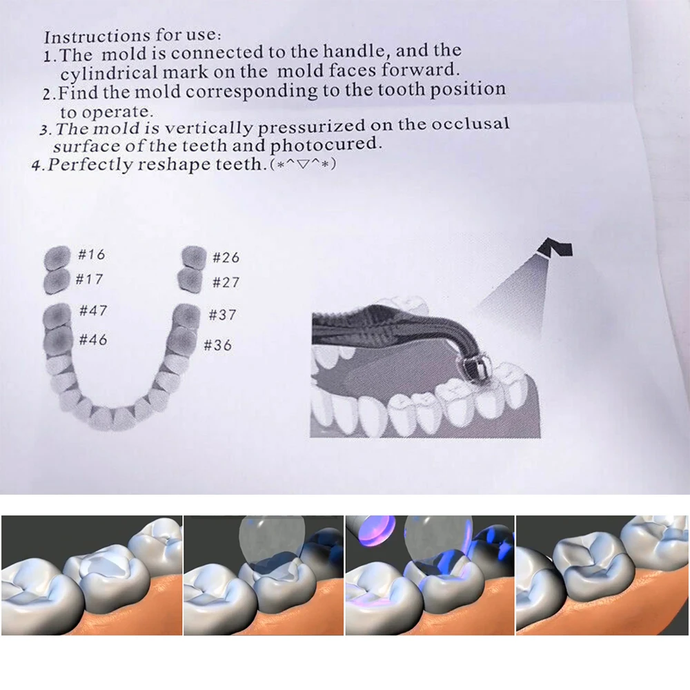 PIORPOY Dental Posterior Teeth Aesthetic Printing Kit 16 Molds Oral Care Orthodontic Filling Restoration Dentist Supplies Tool