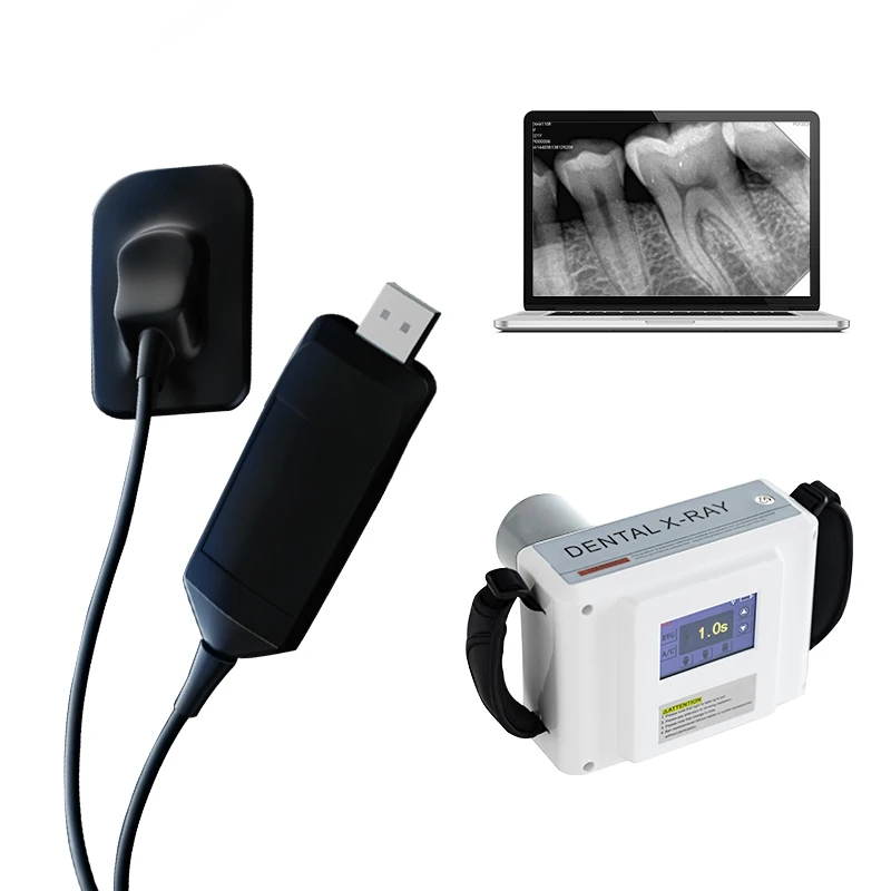 Sensor Oral X Ray Imaging System Intra  Digital rvg Sensor Price