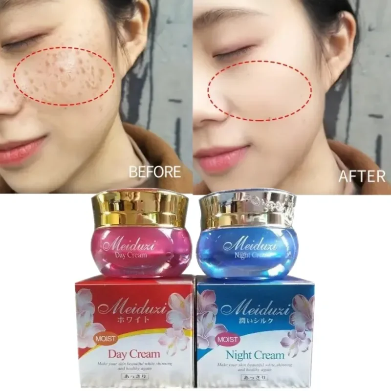 

Original MEIDUZI Skin Care Pigment Skin Whitening Brighten Anti-speckle Removing Freckle Firm Moisturizing Set Day Night Cream