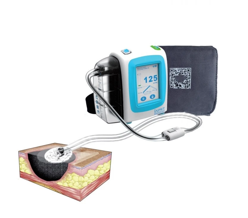 Factory Price Negative Pressure Wound Therapy System Devices Wound VAC Machine and NPWT Dressing Kits
