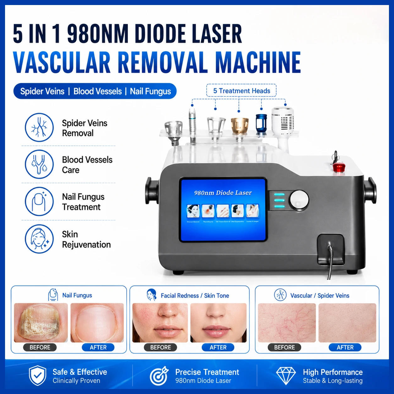 Professional 980nm Diode Laser Machine 5 in 1 for Vascular Clearance Nail Care Recovery Body Physiotherapy Equipment