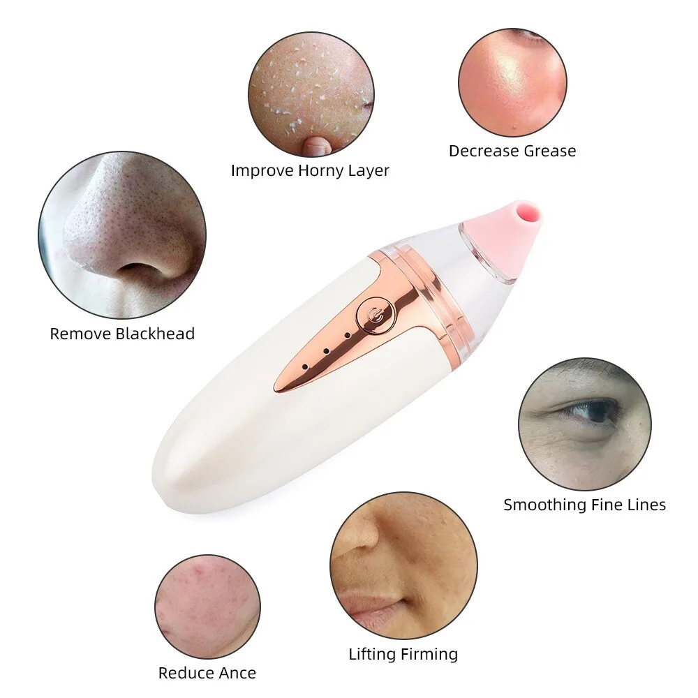 Electric Silicone Blackhead Remover: Acne & Pore Suction, Home Facial Tool for Blackhead/Acne