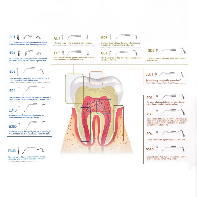 Denspay 1 peça pontas de escamação dental endo perio g p e apto para satelec pica-pau dte raspador ultrassônico periodôntica endodontia