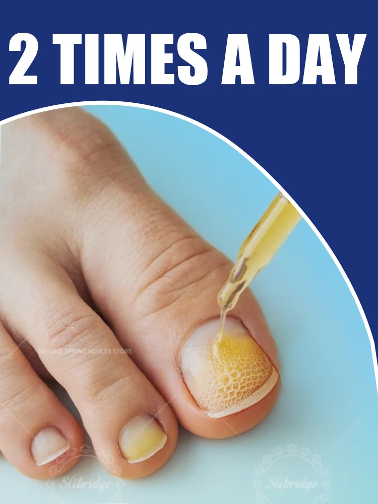 

manicure for bad Can in 7 days farewell