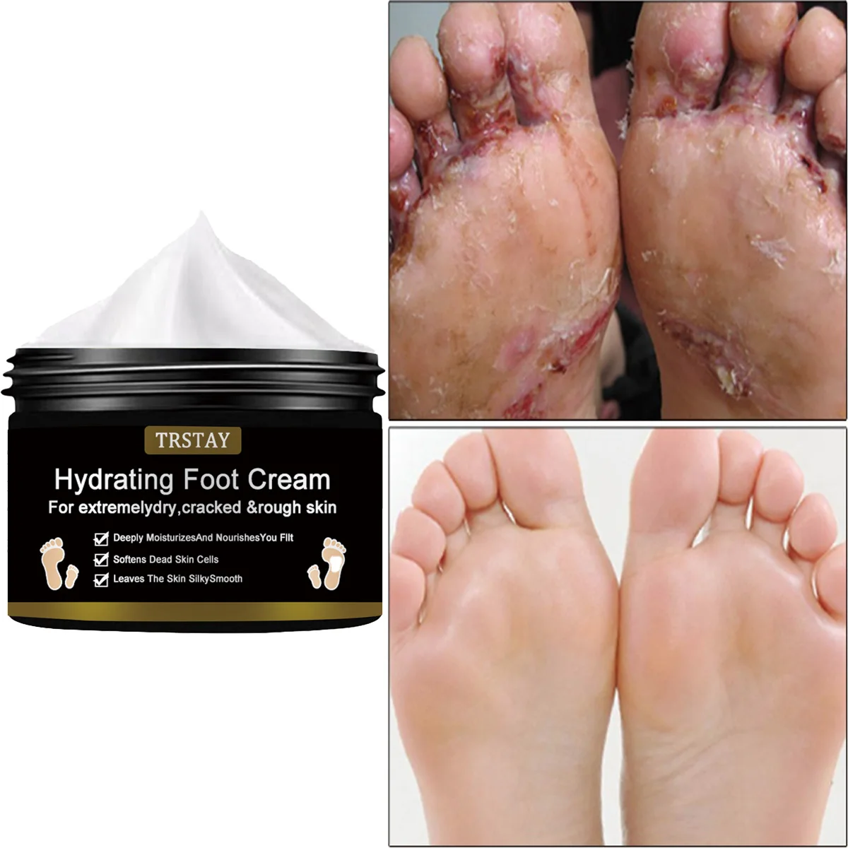 

TRSTAY Увлажняющий крем для ног, глубокое питание для сухой потрескавшейся кожи, омертвевшей кожи, крем для ухода за телом для мам и детей