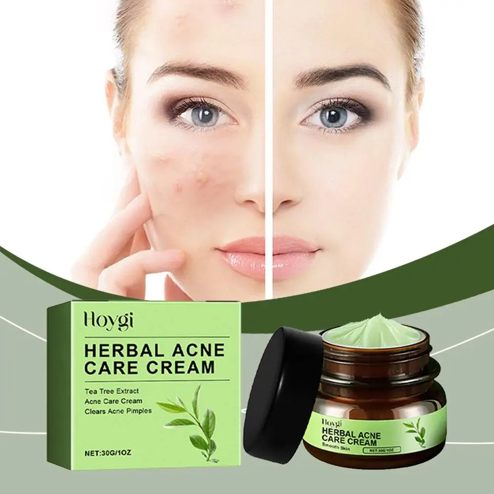 Acne Face Cream Pimple Treatment Oil Control Repair Smooth Redness Remove Hydrating Pore Blackhead Moisturizing Serum Shrin W2l0